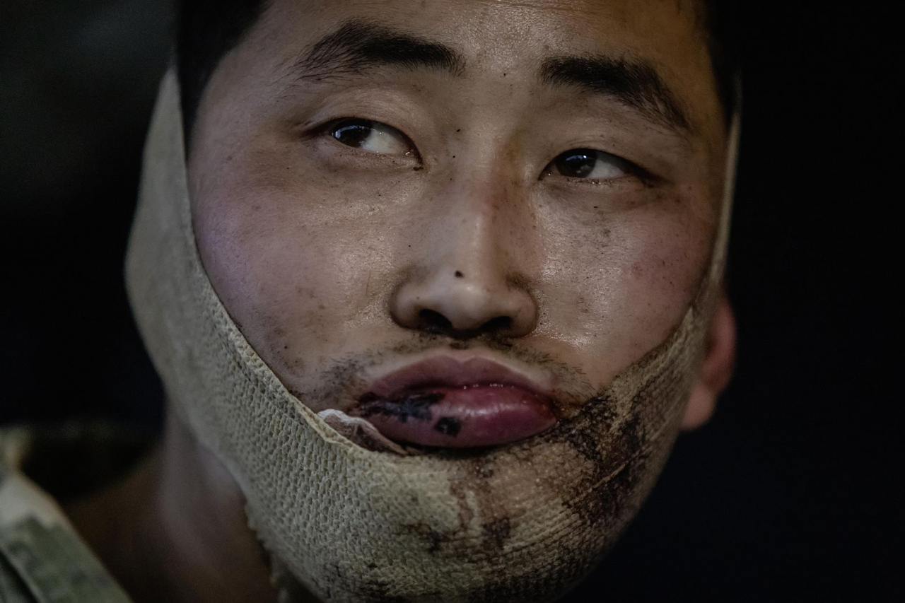 A North Korean POW captured by Ukrainian forces during hostilities in Russia's Kursk Oblast