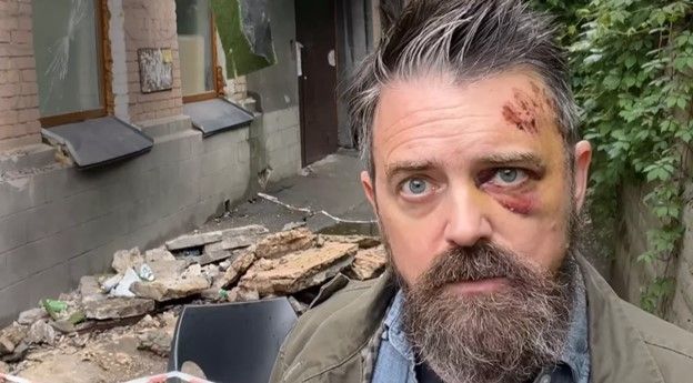 US filmmaker injured by fallen balcony in Kyiv